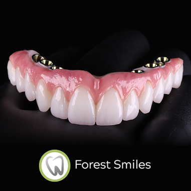 Zirconia Implant Bridge